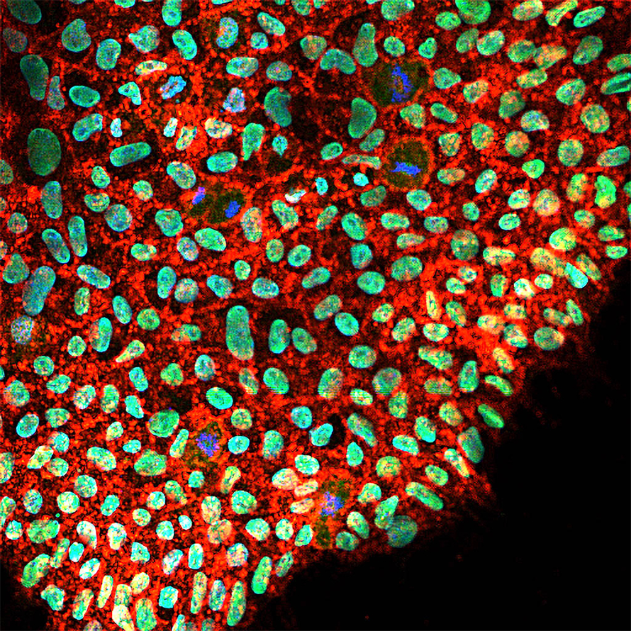 Microscopy image of human induced pluripotent stem cell colony labelled for CD24, a membrane protein, (red); OCT4, a stem cell transcription factor, (green); and cell nuclei (blue).
