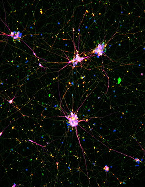 Microscopy image of induced pluripotent stem cells differentiated into neurons labeled with structural proteins beta 3-tubulin (green) and microtubule-associated protein 2 (red) as well as cell nuclei (blue).